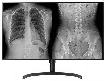 LG DIAGNOSTIC MONITOR, 31.5", 8MP, 450CD/M2, DCI-P3 98%, HAS/PIVOT.